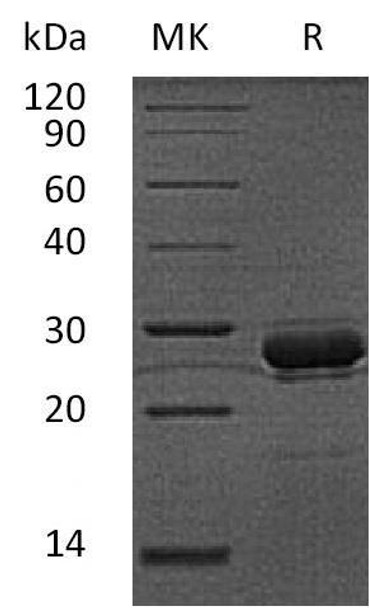 Human Hepcidin/HAMP Recombinant Protein (RPES0682)