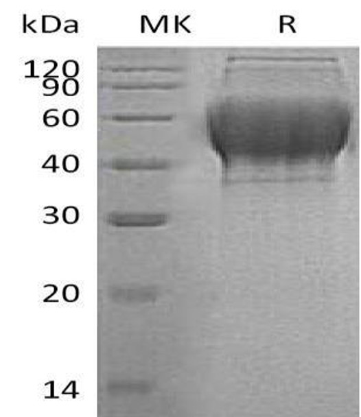 Human TXNDC15 Recombinant Protein (RPES0684)