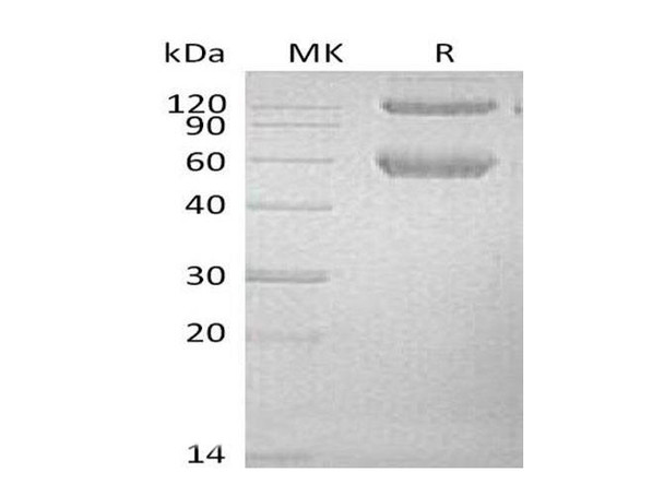 Mouse BMPRIA/ALK-3 Recombinant Protein (RPES0688)