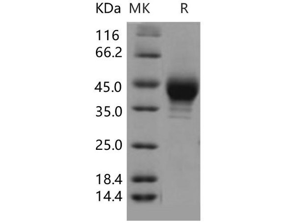 Human SCARB3 Recombinant Protein (RPES0693)