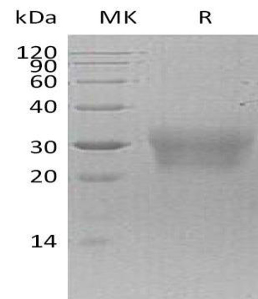 Human NPDC/NPDC1 Recombinant Protein (RPES0701)
