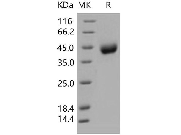 Human SCARB3 Recombinant Protein (RPES0711)