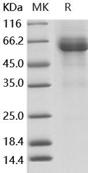 Human LILRB4/CD85k/ILT3 Recombinant Protein (RPES0715)