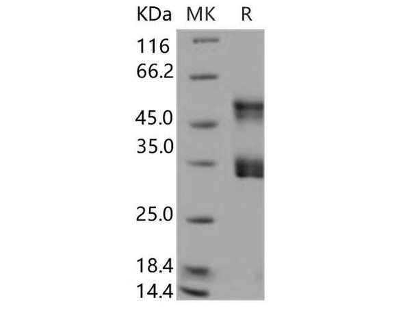 Human Urokinase/uPA Recombinant Protein (RPES0728)