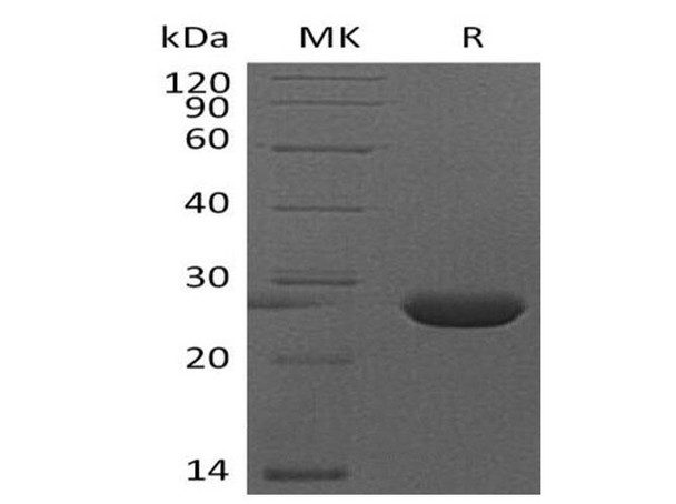 Mouse FGF-9/FGF9 Recombinant Protein (RPES0738)