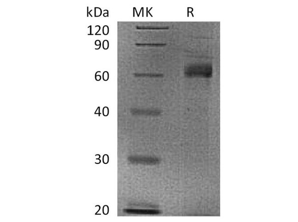 Human Noggin/NOG Recombinant Protein (RPES0741)