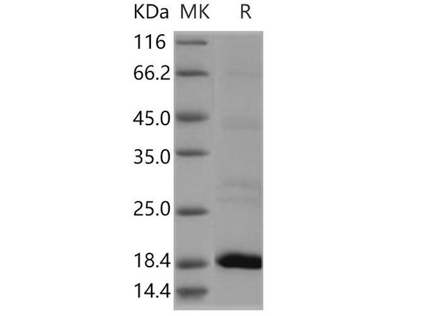 Human Flavokinase/RFK Recombinant Protein (RPES0760)