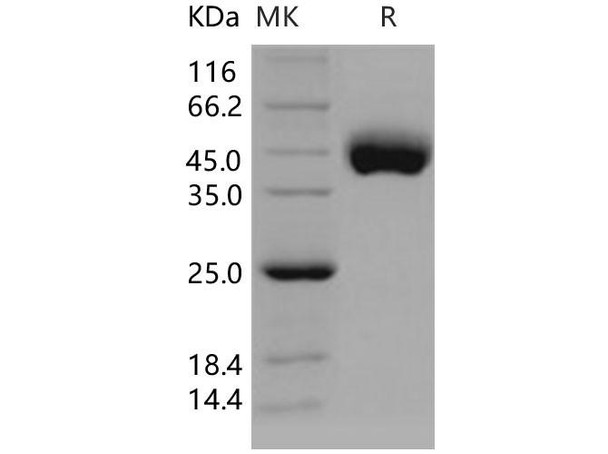 Human CD21/CR2/C3DR Recombinant Protein (RPES0763)