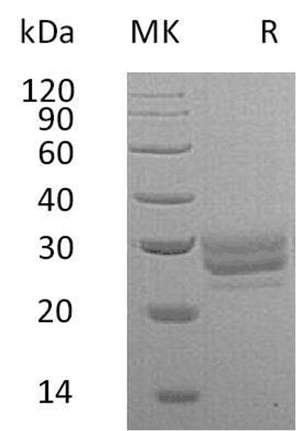 Mouse FLT3LG/Flt3 Ligand Recombinant Protein (RPES0774)