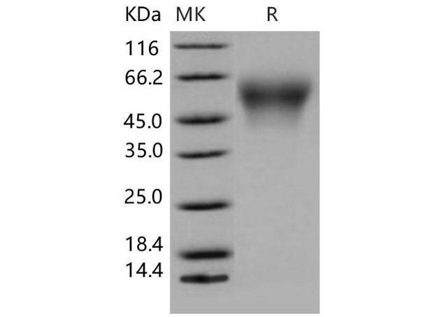 Mouse CES2E Recombinant Protein  (RPES0783)