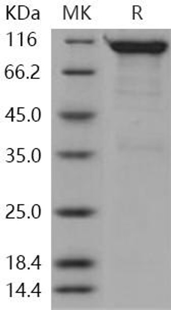 Human SEMA4A/Semaphorin B Recombinant Protein (RPES0784)