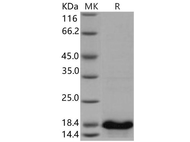 Human UBE2D4 Recombinant Protein (RPES0797)