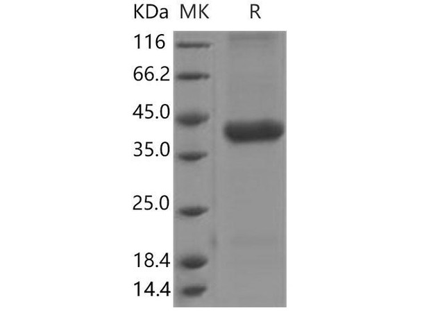 Mouse Cathepsin H/CTSH Recombinant Protein (RPES0802)
