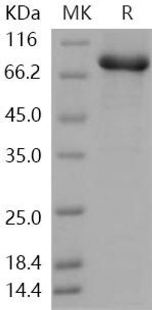 Human STXBP1/UNC18A Recombinant Protein (RPES0803)