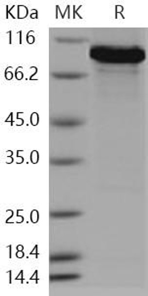 Human ATF2 Recombinant Protein (RPES0817)