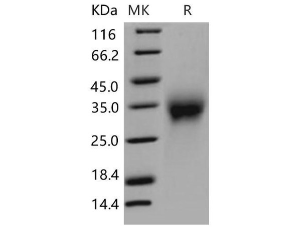 Mouse Activin RIIA/ACVR2A Recombinant Protein (RPES0821)