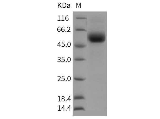 Rat TGFBR2 Recombinant Protein (RPES0838)