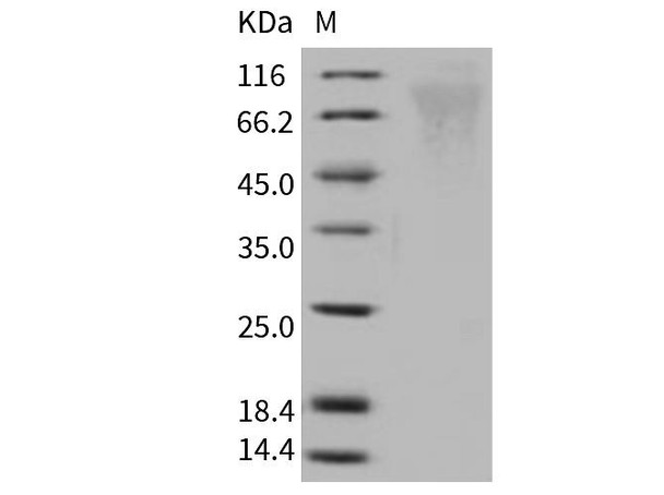 Human Respiratory Syncytial Virus (RPES0841)