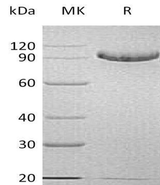 Human CD93/C1QR1 Recombinant Protein (RPES0842)