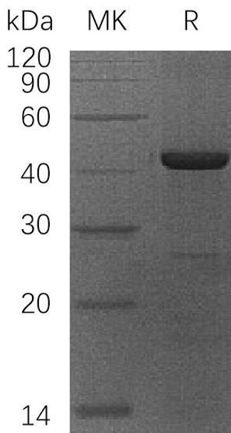 Human OBFC1/STN1 Recombinant Protein (RPES0843)