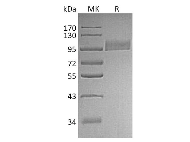 Human CD10/Neprilysin Recombinant Protein (RPES0849)