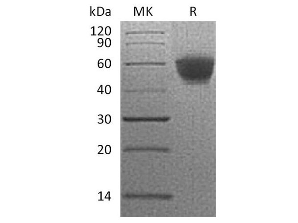 Human NKG2D/CD314 Recombinant Protein (RPES0868)