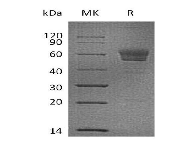 Mouse Podoplanin/PDPN Recombinant Protein (RPES0869)