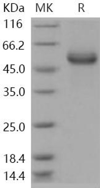 Human HAI/SPINT1 Recombinant Protein (RPES0877)