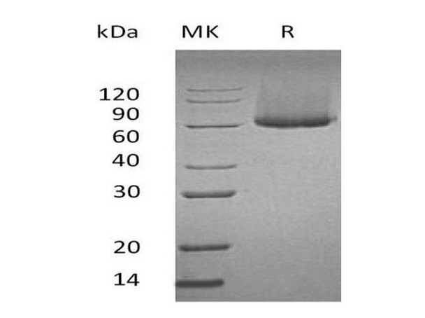 Mouse Glypican/GPC1 Recombinant Protein (RPES0884)