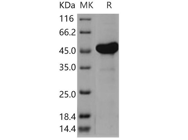 Human AK4/AK3L1 Recombinant Protein (RPES0889)