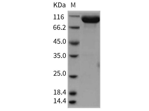 Rat EphA4 Recombinant Protein (RPES0893)