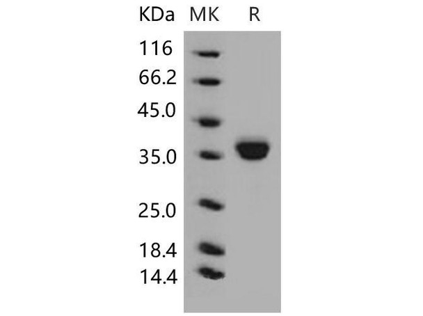 Mouse EpCAM/TROP Recombinant Protein (RPES0930)