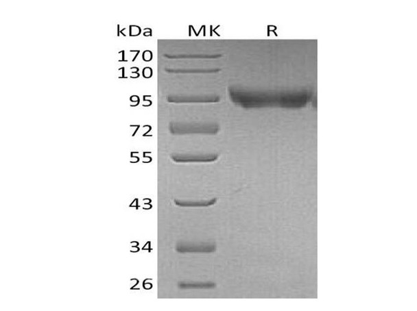 Mouse CD31/PECAM1 Recombinant Protein (RPES0942)