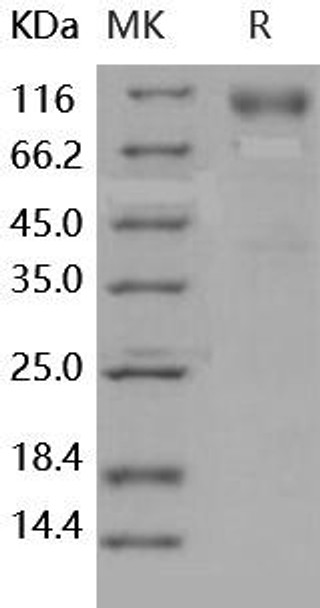 Human DR6/TNFRSF21 Recombinant Protein (RPES0946)