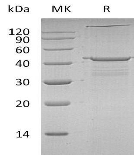 Human IGF2BP2 Recombinant Protein (RPES0952)