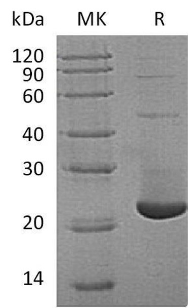 Human TMX2/TXNDC14 Recombinant Protein (RPES0954)