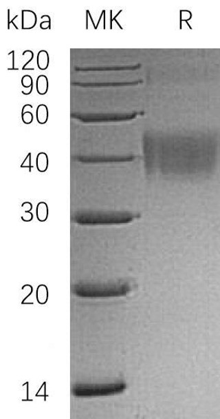 Human OX-2/MOX1/CD200 Recombinant Protein (RPES0972)