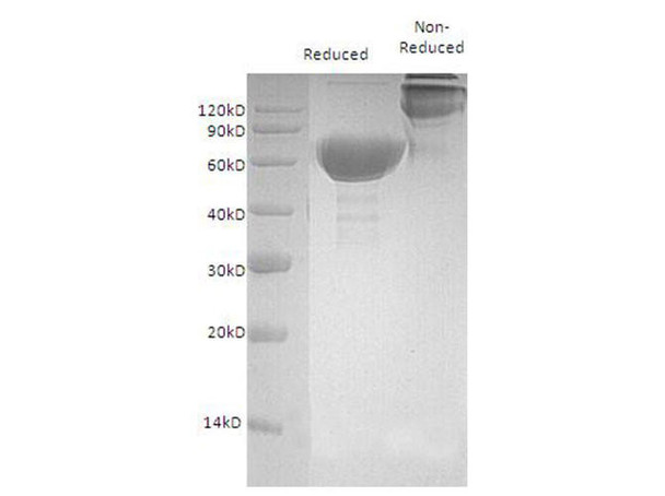 Mouse OX40/TNFRSF4 Recombinant Protein (RPES0979)