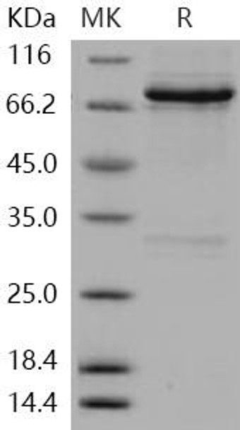 Human RET Kinase Recombinant Protein (RPES0980)