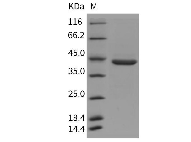 Rat Pepsinogen C/PGC Recombinant Protein (RPES0985)
