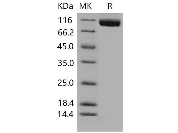 Mouse VEGFR3/FLT4 Recombinant Protein (RPES0986)