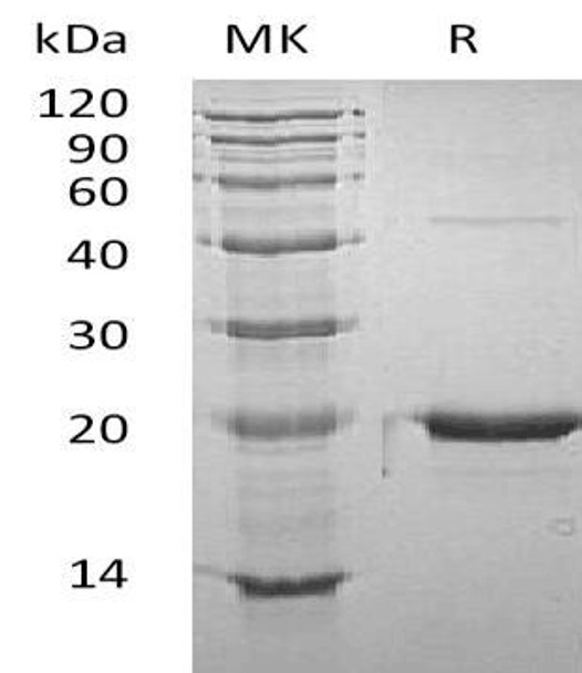 Mouse GH1/Growth Hormone Recombinant Protein (RPES0993)