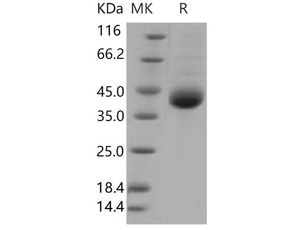 Human Kallikrein 11/KLK11 Recombinant Protein (RPES0999)