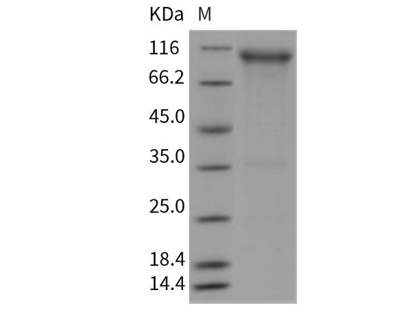 Rat FGFR4/CD334 Recombinant Protein (RPES1001)