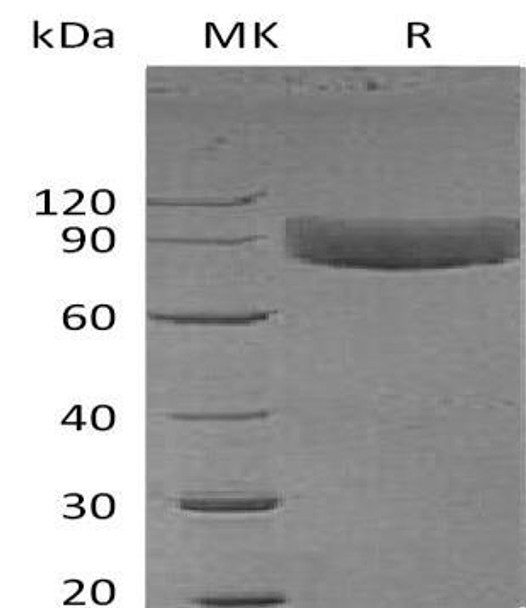 Human IL1R1/CD121a Recombinant Protein (RPES1006)