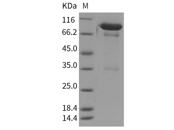 Mouse PGRL/IGSF8 Recombinant Protein (RPES1009)