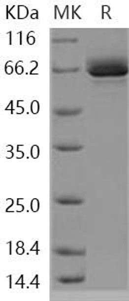 Human EphB1/EPHT2 Recombinant Protein (RPES1015)