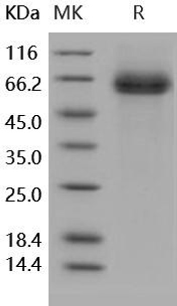 Human DLL4 Recombinant Protein (RPES1017)