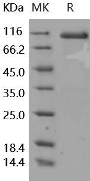 Human DLL4 Recombinant Protein (RPES1034)