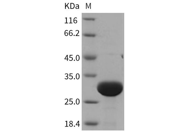 Rat UCHL3/UCH-L3 Recombinant Protein (RPES1035)